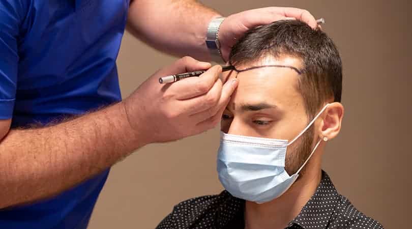 hair transplant treatment in ahmedabad