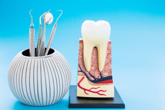 painless root canal treatment in ahmedabad