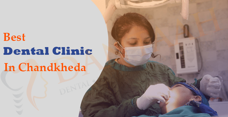 Best Dental Clinic in Chandkheda  