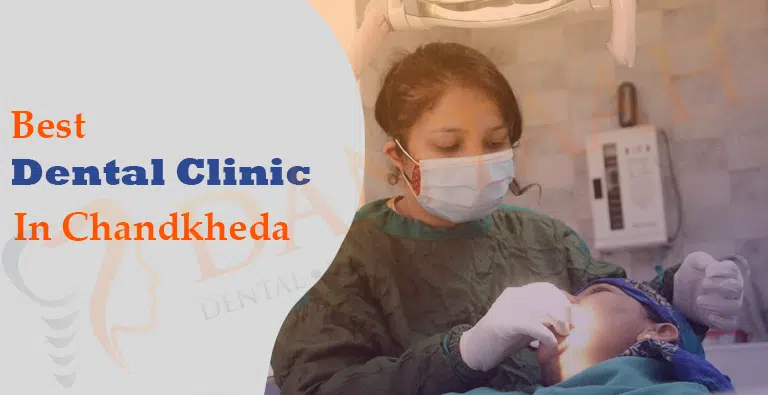 Best Dental Clinic in Chandkheda  