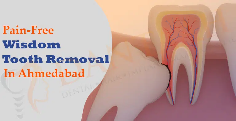 Painless Wisdom Tooth Removal in Ahmedabad  