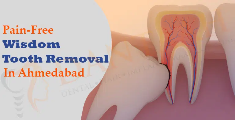 Painless Wisdom Tooth Removal in Ahmedabad