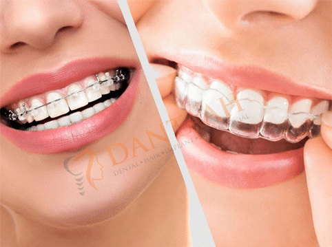 Best Smiles Orthodontics in Ahmedabad