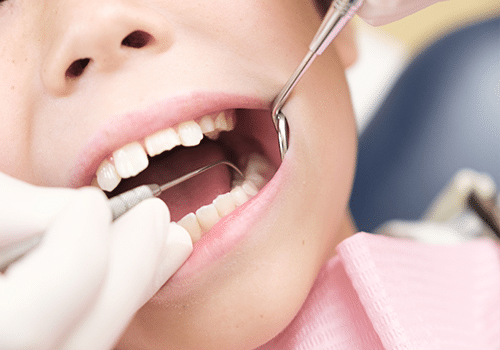 Emergency Root Canal Treatment in Chandkheda  